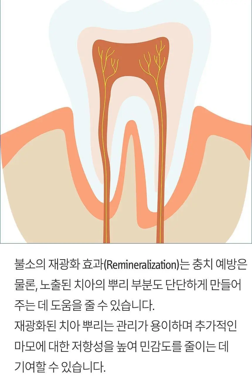 [고불소] 큐라덴 큐라프록스 엔자이칼 치약 1450 상세페이지 10